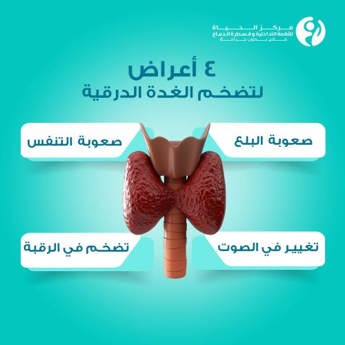 أعراض تضخم الغدة الدرقية البسيط